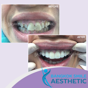 Bangkok Smile Aesthetic Clinic